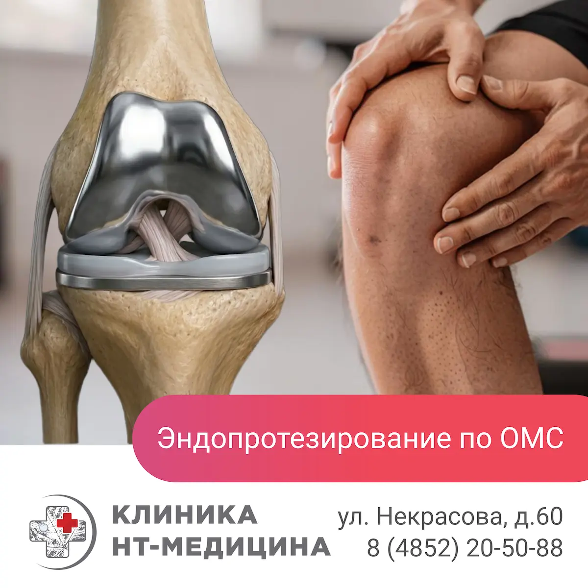 Эндопротезирование по ОМС