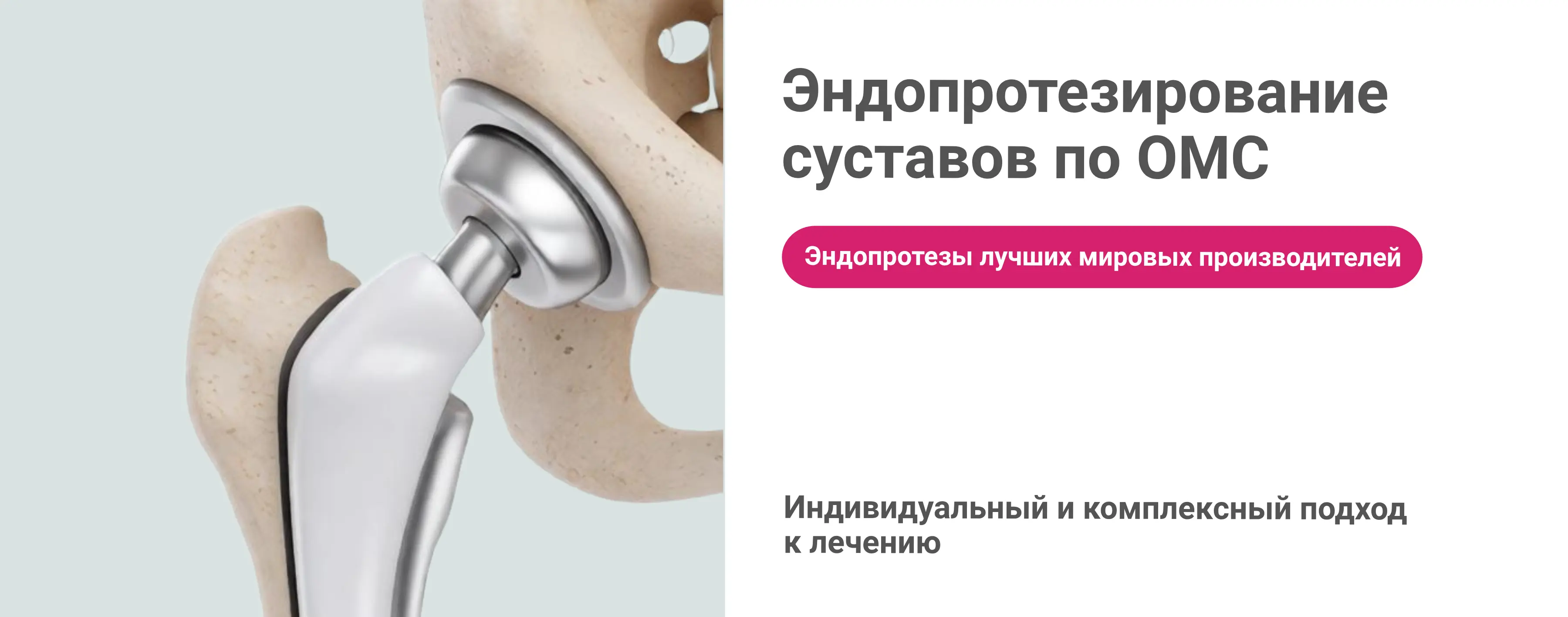 Эндопротезирование по ОМС 