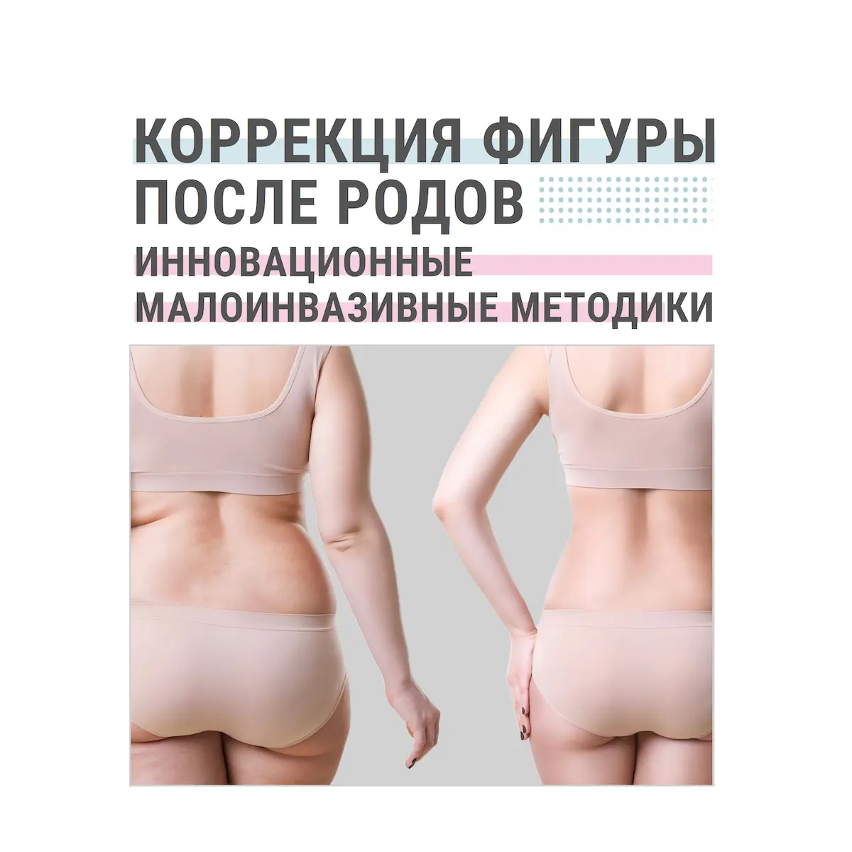 Коррекция фигуры после родов