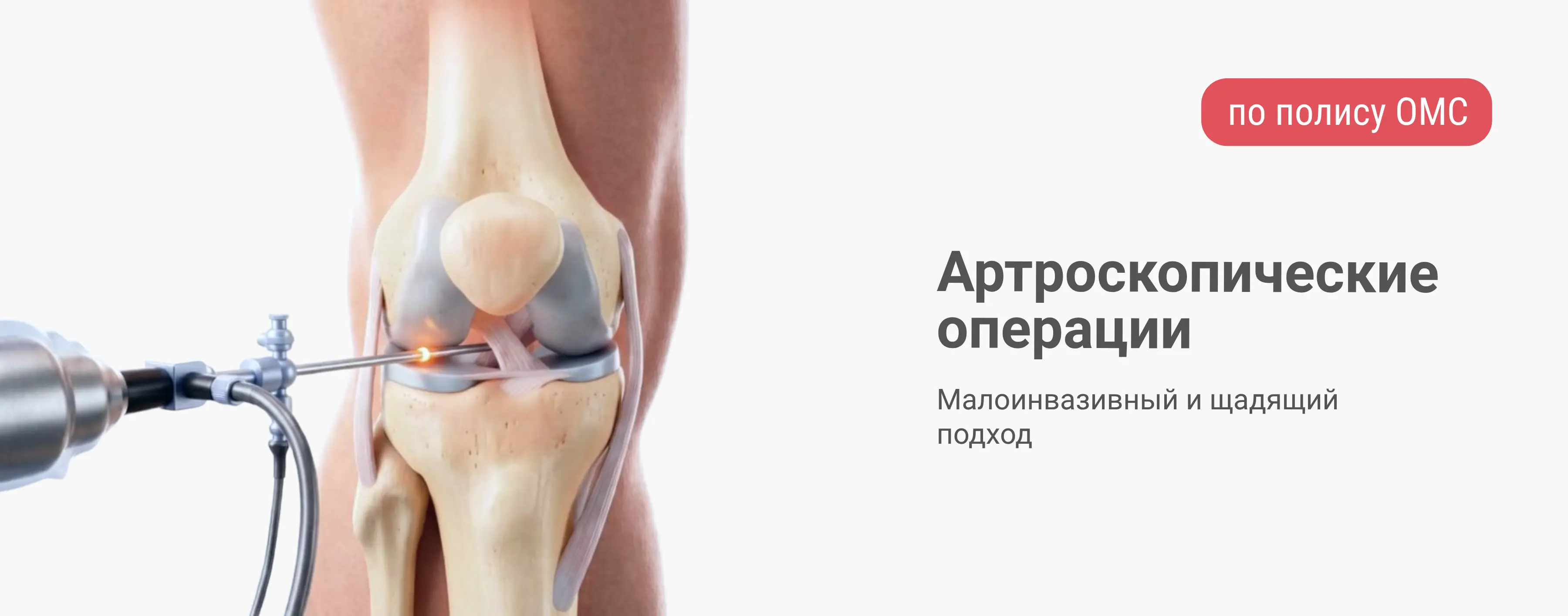 Высокотехнологичное артроскопическое лечение по ОМС
