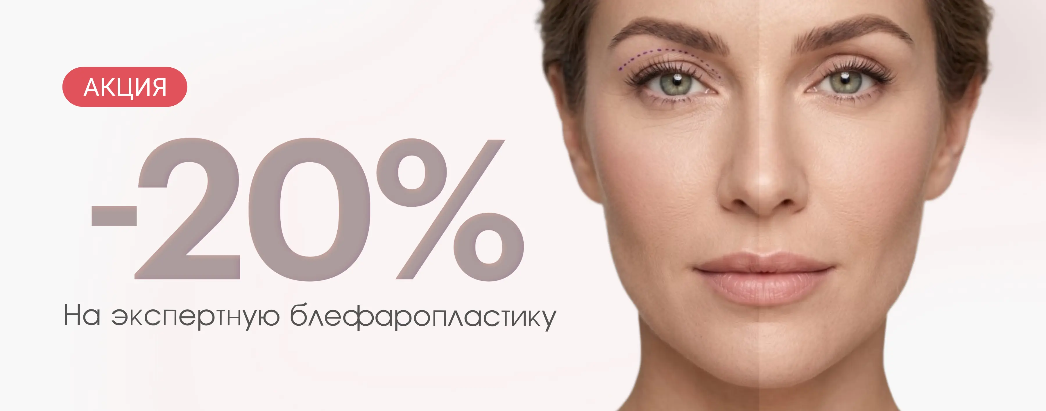 Экспертная блефаропластика в Ярославле от московского пластического хирурга 