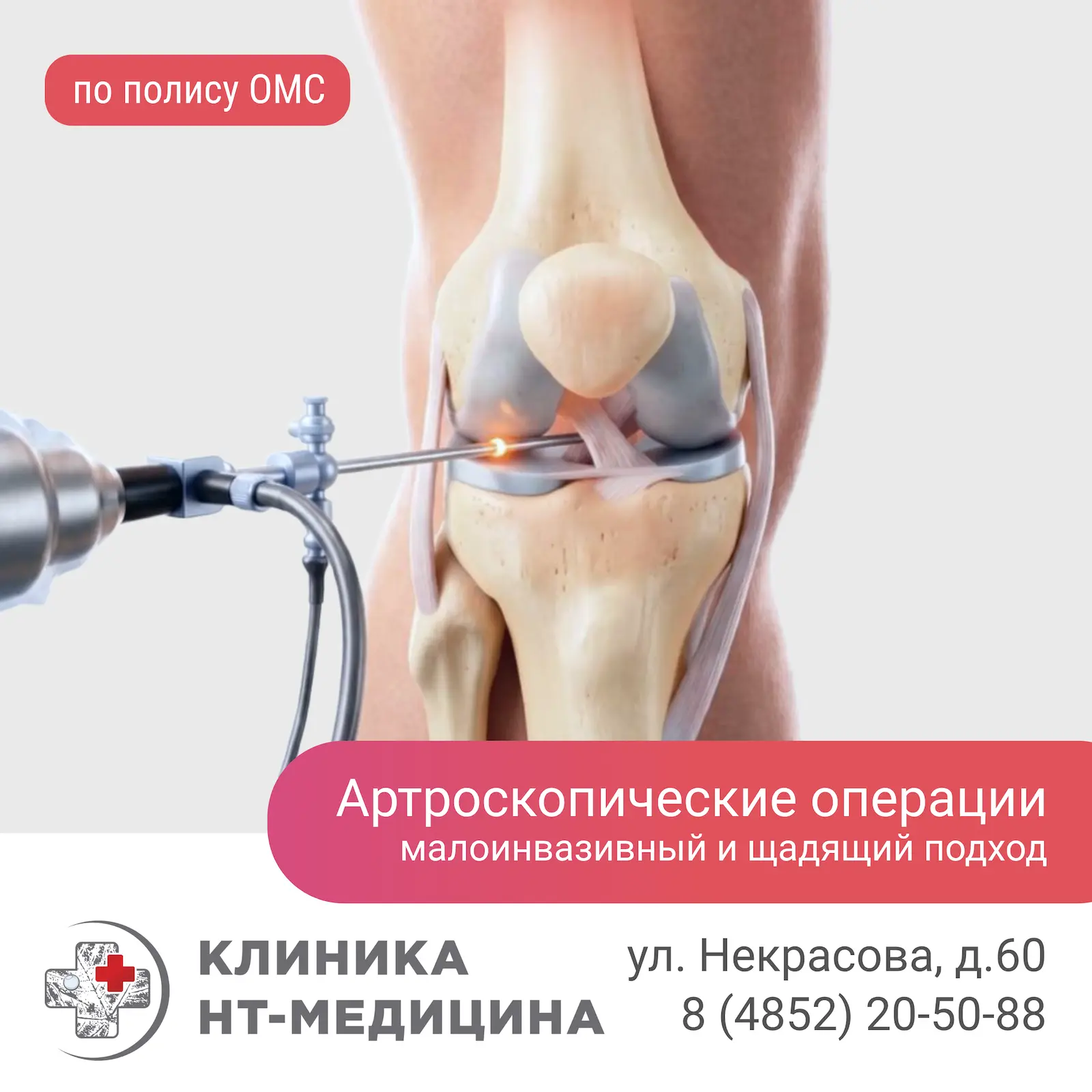 Высокотехнологичное артроскопическое лечение по ОМС