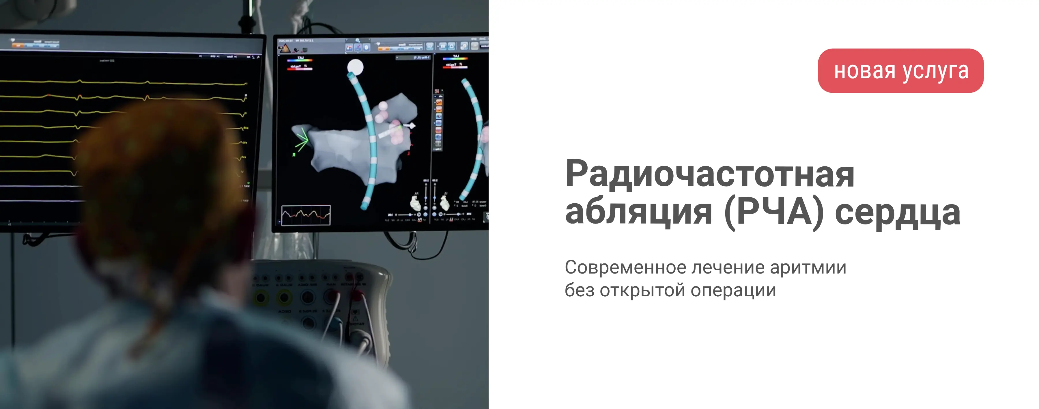 Радиочастотная аблация