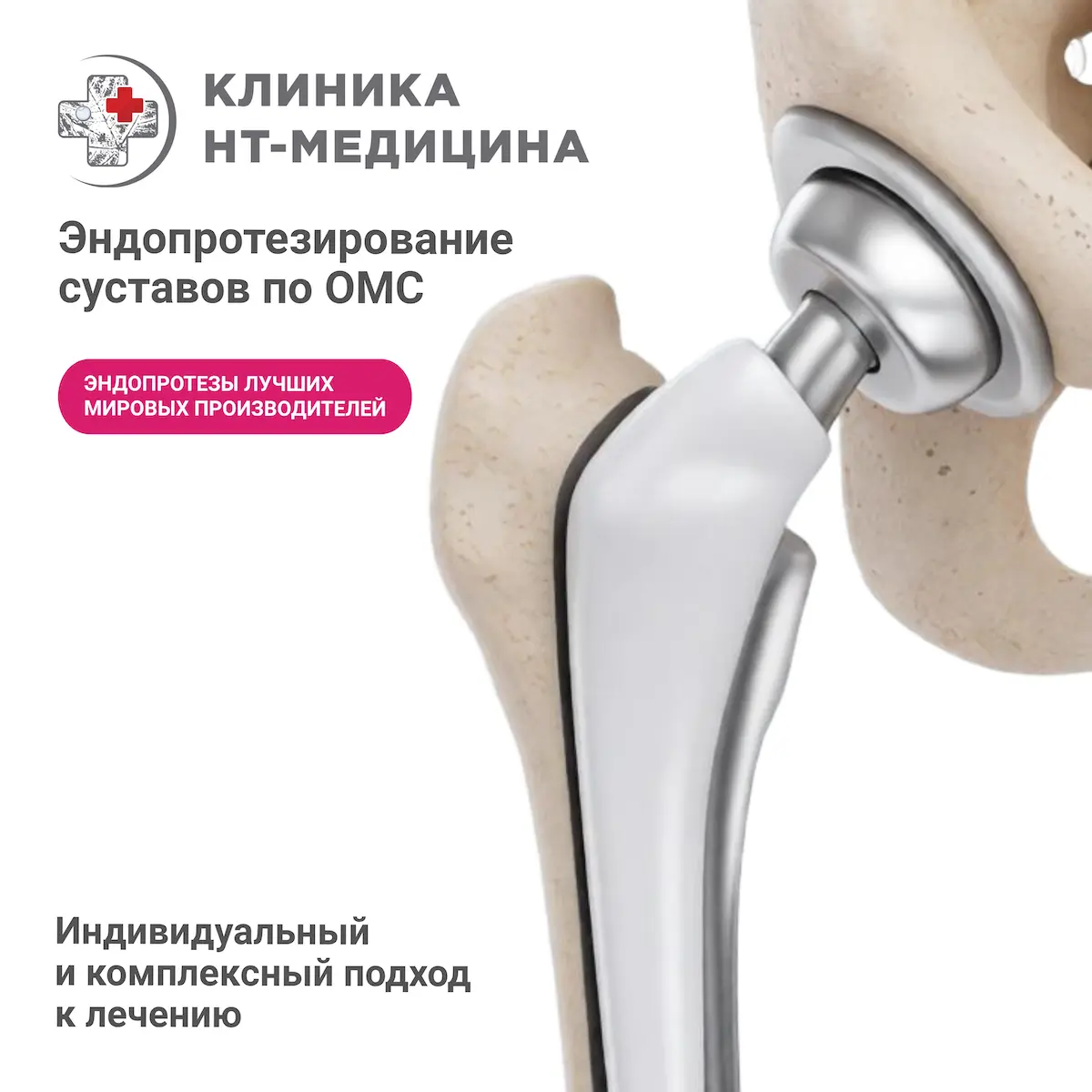 Эндопротезирование по ОМС